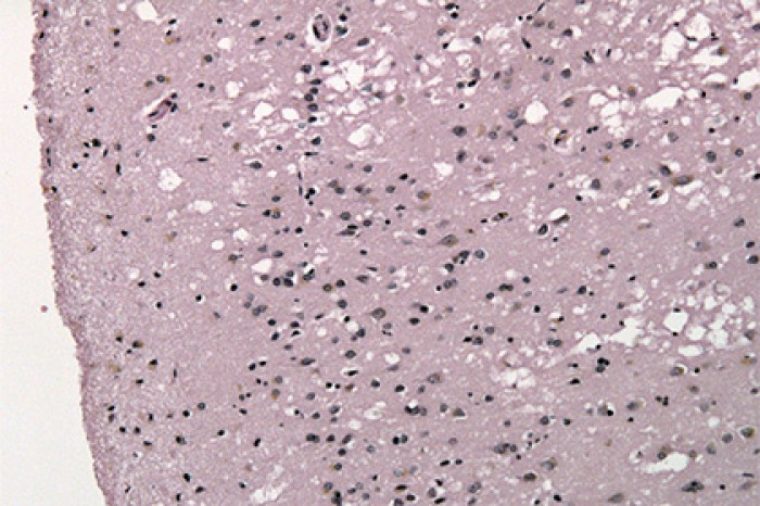 Найдено средство против смертельно опасных белков