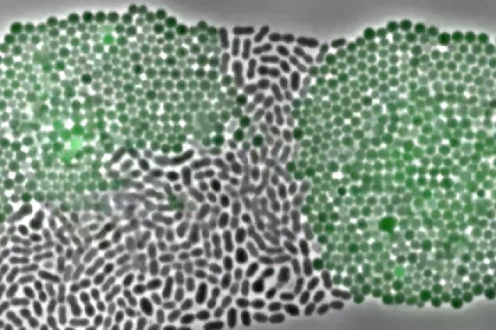 Неуязвимых к лекарствам микробов показали на видео