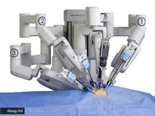 Робот впервые пересадил поджелудочную железу