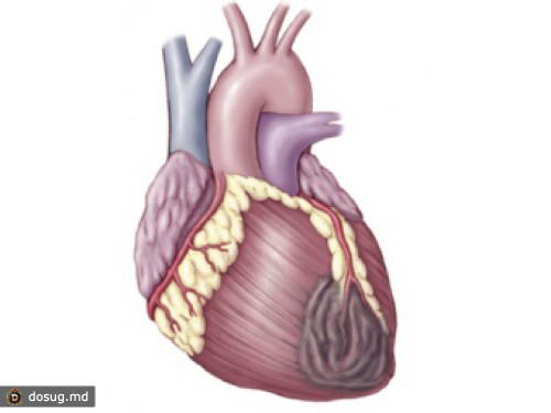 Британцы "разбудили" стволовые клетки для восстановления сердечной мышцы