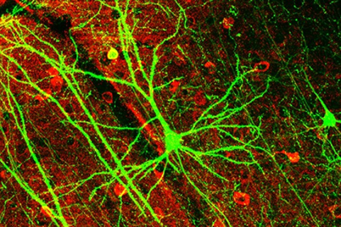 Впервые зафиксирована работа человеческого мозга после смерти