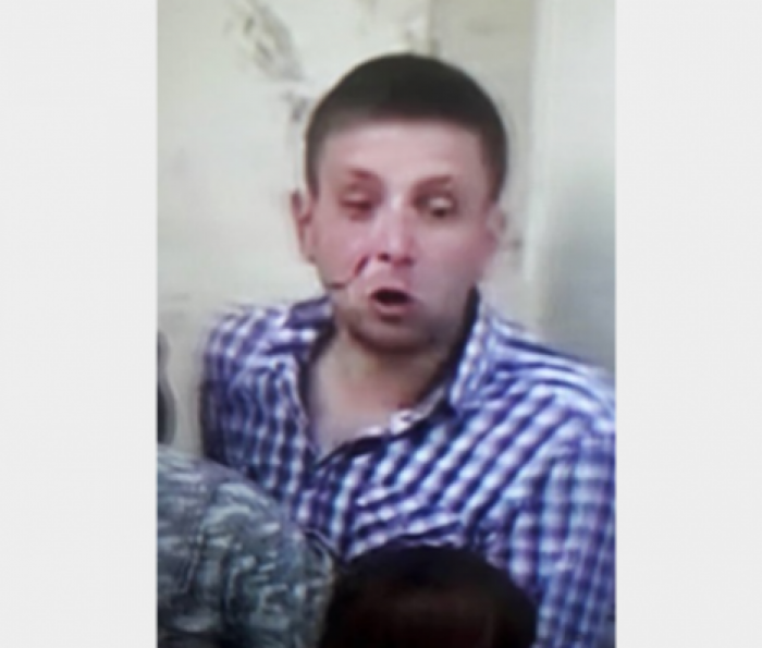 В Верховной Раде избили до крови народного депутата