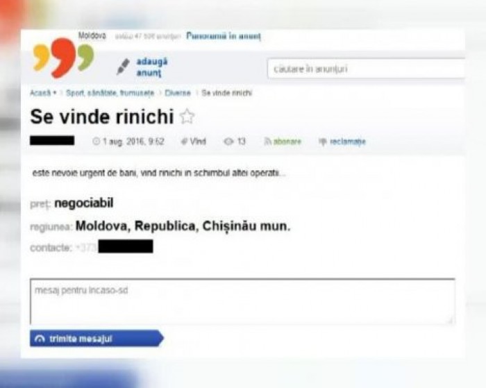 Женщина из Молдовы пытается продать собственную почку за €1600