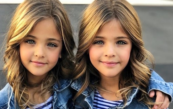 СМИ показали "самых красивых в мире" близняшек