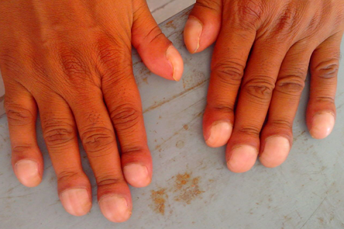 Большие ногти на пальцах рук. Короткие пальцы у мужчины