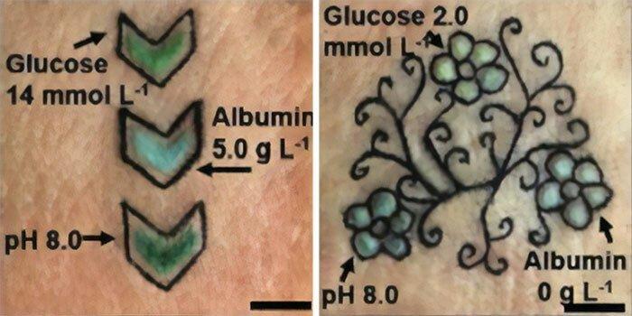 Разработаны биосенсорные татуировки для мониторинга хронических заболеваний