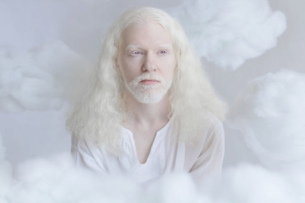 Завораживающая и необычная красота людей-альбиносов