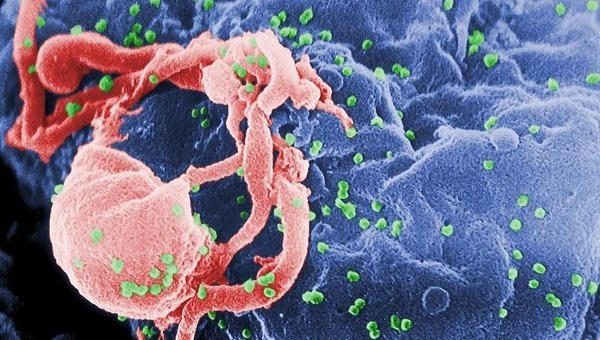 Итальянские ученые обнаружили белок, защищающий от ВИЧ